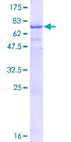 CT47A11 Protein - 12.5% SDS-PAGE of human RP6-166C19.11 stained with Coomassie Blue