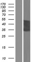 CT47A5 Protein - Western validation with an anti-DDK antibody * L: Control HEK293 lysate R: Over-expression lysate