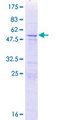CT55 / CXorf48 Protein - 12.5% SDS-PAGE of human CXorf48 stained with Coomassie Blue