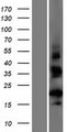 CT62 Protein - Western validation with an anti-DDK antibody * L: Control HEK293 lysate R: Over-expression lysate