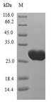 CT83 / CXorf61 Protein - (Tris-Glycine gel) Discontinuous SDS-PAGE (reduced) with 5% enrichment gel and 15% separation gel.