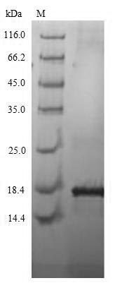 CT83 / CXorf61 Protein - (Tris-Glycine gel) Discontinuous SDS-PAGE (reduced) with 5% enrichment gel and 15% separation gel.