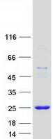 CTAG1A Protein - Purified recombinant protein CTAG1A was analyzed by SDS-PAGE gel and Coomassie Blue Staining