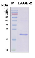CTAG1B / NY-ESO-1 Protein - SDS-PAGE under reducing conditions and visualized by Coomassie blue staining