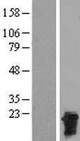 CTAG2 Protein - Western validation with an anti-DDK antibody * L: Control HEK293 lysate R: Over-expression lysate