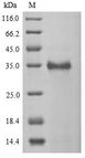 CTAG2 Protein - (Tris-Glycine gel) Discontinuous SDS-PAGE (reduced) with 5% enrichment gel and 15% separation gel.