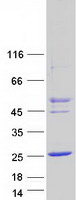 CTAG2 Protein - Purified recombinant protein CTAG2 was analyzed by SDS-PAGE gel and Coomassie Blue Staining