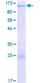 CTAGE1 / CTAGE Protein - 12.5% SDS-PAGE of human CTAGE1 stained with Coomassie Blue