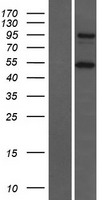 CTAGE5 Protein - Western validation with an anti-DDK antibody * L: Control HEK293 lysate R: Over-expression lysate