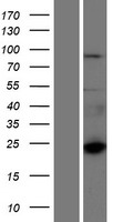 CTAGE6 Protein - Western validation with an anti-DDK antibody * L: Control HEK293 lysate R: Over-expression lysate