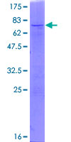 CTB / PCYT1B Protein - 12.5% SDS-PAGE of human PCYT1B stained with Coomassie Blue