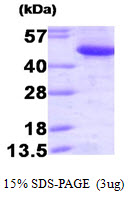 CTBP1 / CTBP Protein