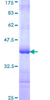 CTBP2 Protein - 12.5% SDS-PAGE Stained with Coomassie Blue.