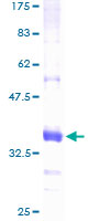 CTBS / CTB Protein - 12.5% SDS-PAGE of human CTBS stained with Coomassie Blue