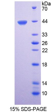 CTBS / CTB Protein - Recombinant  Di-N-Acetyl Chitobiase By SDS-PAGE
