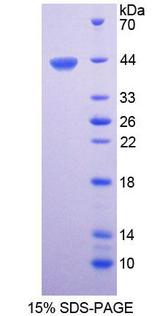 CTBS / CTB Protein - Recombinant  Di-N-Acetyl Chitobiase By SDS-PAGE