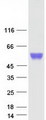 CTBS / CTB Protein - Purified recombinant protein CTBS was analyzed by SDS-PAGE gel and Coomassie Blue Staining