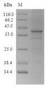CTCF Protein - (Tris-Glycine gel) Discontinuous SDS-PAGE (reduced) with 5% enrichment gel and 15% separation gel.