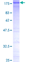 CTCF Protein - 12.5% SDS-PAGE of human CTCF stained with Coomassie Blue