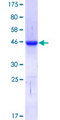 CTCF Protein - 12.5% SDS-PAGE Stained with Coomassie Blue.