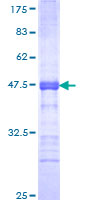CTCFL / BORIS Protein - 12.5% SDS-PAGE Stained with Coomassie Blue.