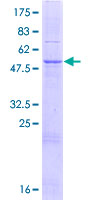 CTDNEP1 / DULLARD Protein - 12.5% SDS-PAGE of human DULLARD stained with Coomassie Blue