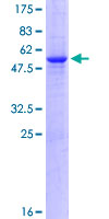 CTDSP1 / SCP1 Protein - 12.5% SDS-PAGE of human CTDSP1 stained with Coomassie Blue