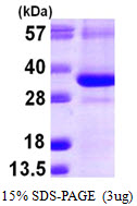 CTDSP1 / SCP1 Protein