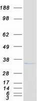 CTDSP1 / SCP1 Protein - Purified recombinant protein CTDSP1 was analyzed by SDS-PAGE gel and Coomassie Blue Staining