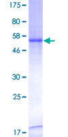 CTDSP2 Protein - 12.5% SDS-PAGE of human CTDSP2 stained with Coomassie Blue