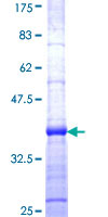 CTDSP2 Protein - 12.5% SDS-PAGE Stained with Coomassie Blue.