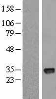 CTDSPL Protein - Western validation with an anti-DDK antibody * L: Control HEK293 lysate R: Over-expression lysate