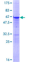 CTDSPL Protein - 12.5% SDS-PAGE of human CTDSPL stained with Coomassie Blue