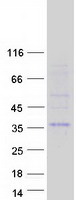 CTDSPL Protein - Purified recombinant protein CTDSPL was analyzed by SDS-PAGE gel and Coomassie Blue Staining