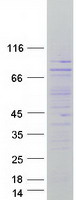 CTDSPL2 Protein - Purified recombinant protein CTDSPL2 was analyzed by SDS-PAGE gel and Coomassie Blue Staining