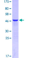 CTF1 / Cardiotrophin-1 Protein - 12.5% SDS-PAGE of human CTF1 stained with Coomassie Blue