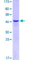 CTF1 / Cardiotrophin-1 Protein - 12.5% SDS-PAGE of human CTF1 stained with Coomassie Blue
