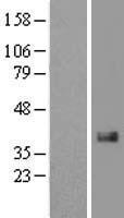 CTGF Protein - Western validation with an anti-DDK antibody * L: Control HEK293 lysate R: Over-expression lysate