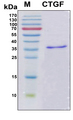 CTGF Protein - SDS-PAGE under reducing conditions and visualized by Coomassie blue staining