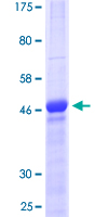 CTGF Protein - 12.5% SDS-PAGE of human CTGF stained with Coomassie Blue
