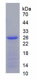 CTH / Cystathionase Protein - Recombinant Cystathionine Gamma Lyase By SDS-PAGE