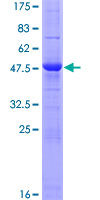 CTHRC1 Protein - 12.5% SDS-PAGE of human CTHRC1 stained with Coomassie Blue