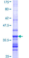 CTHRC1 Protein - 12.5% SDS-PAGE Stained with Coomassie Blue.