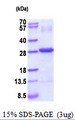 CTHRC1 Protein
