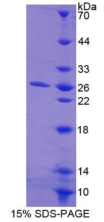CTHRC1 Protein - Recombinant  Collagen Triple Helix Repeat Containing Protein 1 By SDS-PAGE