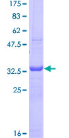 CTLA4 / CD152 Protein - 12.5% SDS-PAGE Stained with Coomassie Blue.