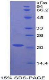 CTLA4 / CD152 Protein - Recombinant Cytotoxic T-Lymphocyte Associated Antigen 4 By SDS-PAGE