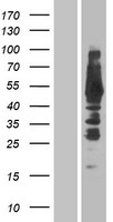CTMP / THEM4 Protein - Western validation with an anti-DDK antibody * L: Control HEK293 lysate R: Over-expression lysate