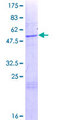 CTMP / THEM4 Protein - 12.5% SDS-PAGE of human THEM4 stained with Coomassie Blue