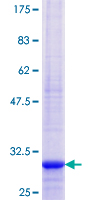CTMP / THEM4 Protein - 12.5% SDS-PAGE Stained with Coomassie Blue.